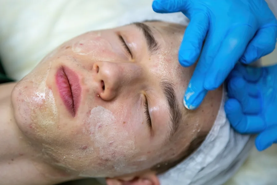Homem a receber tratamento de acne num ambiente clínico e relaxante.